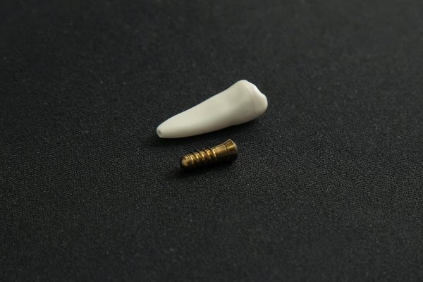 Les implants dentaires sont-ils disponibles chez Prisma Dentistes ?